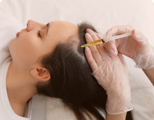 mesotherapy treatment at VLCC for hair rejuvenation and wellness